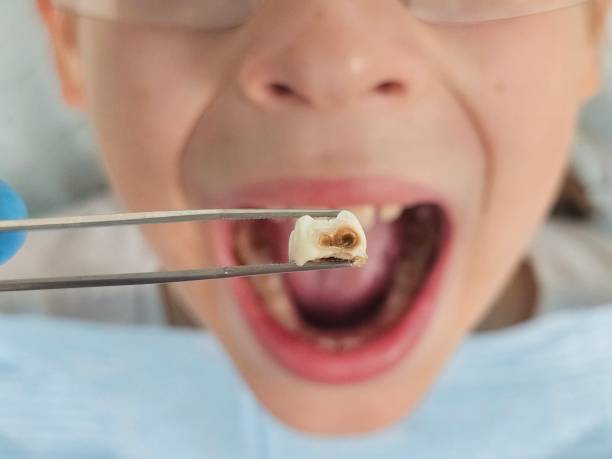 Best Emergency Dental Surgery in Schoolcraft, MI