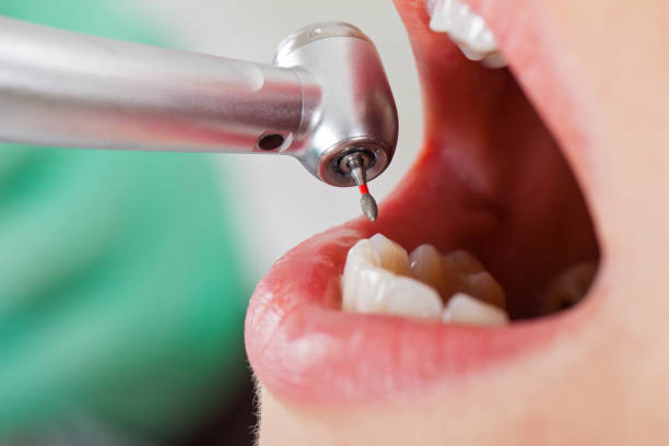 Best Emergency Treatment for Toothache in Schoolcraft, MI